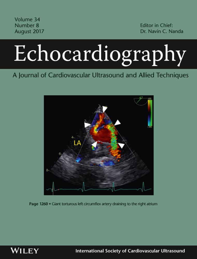 Echocardiography