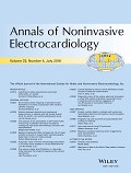 Chest-lead ST­J amplitudes using arm electrodes as Reference instead of the Wilson central terminal in smartphone ECG applications: Influence on ST-elevation myocardial infarction criteria fulfillment